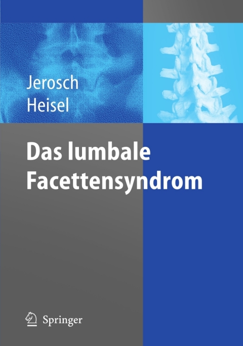 Cover image for book Das lumbale Facettensyndrom