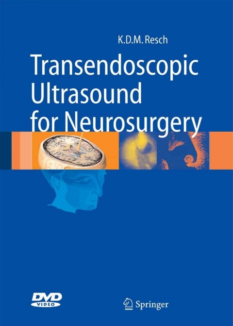 Cover image for book Transendoscopic Ultrasound for Neurosurgery