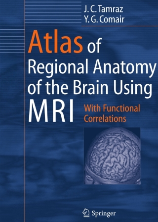 Atlas of Regional Anatomy of the Brain Using MRI