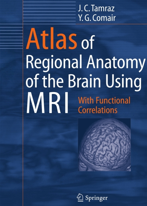 Cover image for book Atlas of Regional Anatomy of the Brain Using MRI