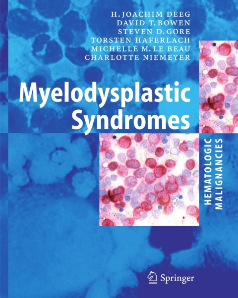 Cover image for book Myelodysplastic Syndromes