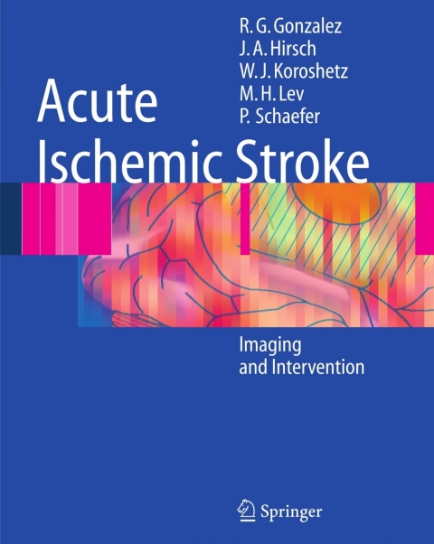 Acute Ischemic Stroke 