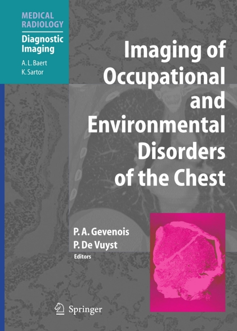 Cover image for book Imaging of Occupational and Environmental Disorders of the Chest