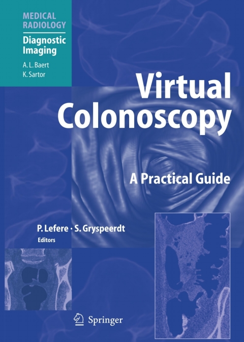 Cover image for book Virtual Colonoscopy