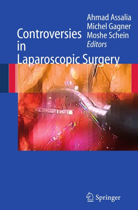 Cover image for book Controversies in Laparoscopic Surgery