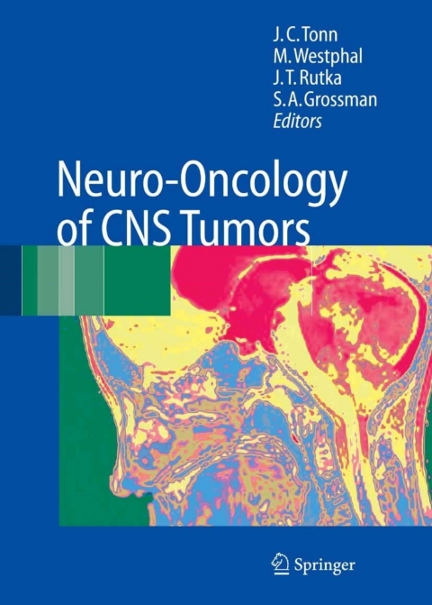Cover image for book Neuro-Oncology of CNS Tumors