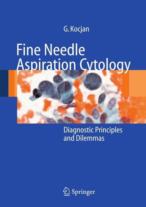 Cover image for book Fine Needle Aspiration Cytology