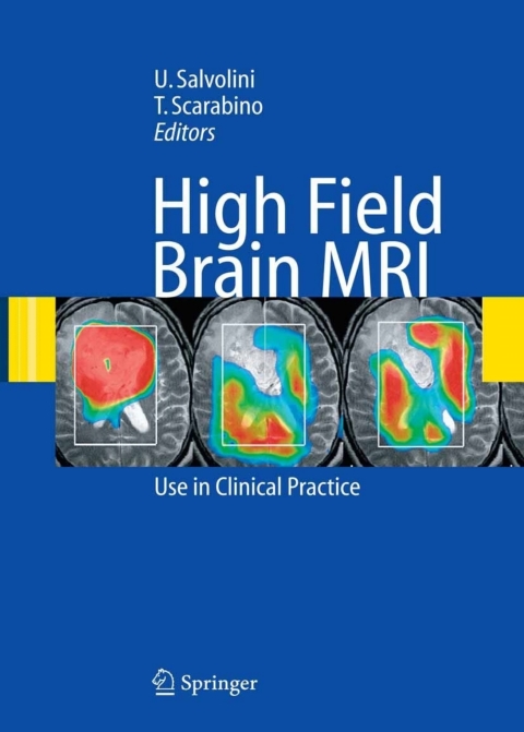 Cover image for book High Field Brain MRI