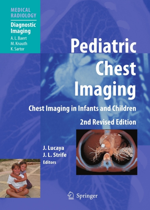 Cover image for book Pediatric Chest Imaging