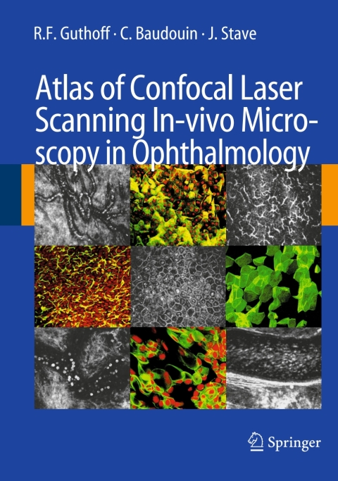 Cover image for book Atlas of Confocal Laser Scanning In-vivo Microscopy in Ophthalmology