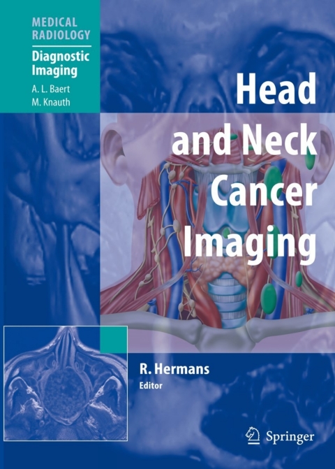 Cover image for book Head and Neck Cancer Imaging