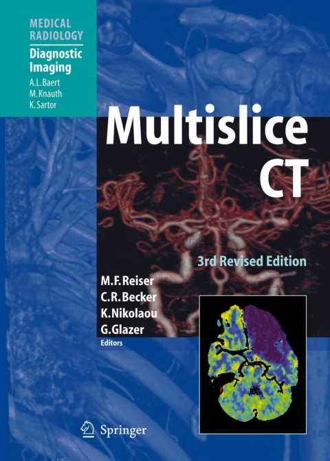 Cover image for book Multislice CT