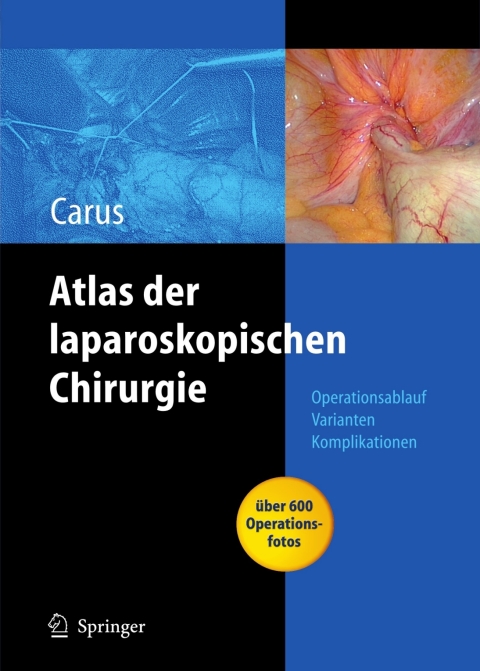 Cover image for book Operationsatlas Laparoskopische Chirurgie