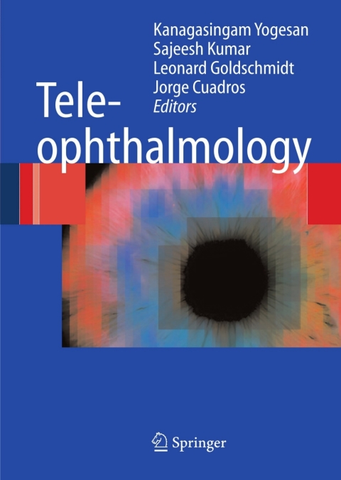Cover image for book Teleophthalmology