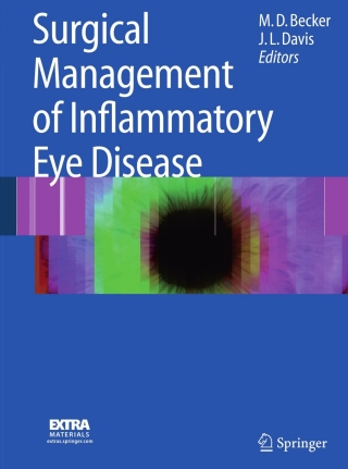 Surgical Management of Inflammatory Eye Disease