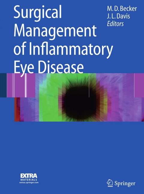 Cover image for book Surgical Management of Inflammatory Eye Disease