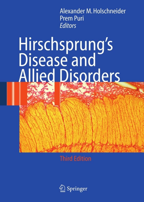 Cover image for book Hirschsprung's Disease and Allied Disorders