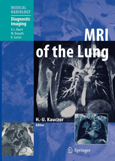 Cover image for book MRI of the Lung