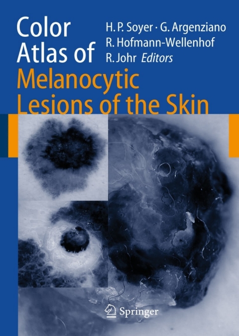 Cover image for book Color Atlas of Melanocytic Lesions of the Skin
