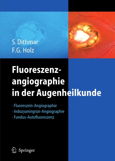 Cover image for book Fluoreszenzangiographie in der Augenheilkunde