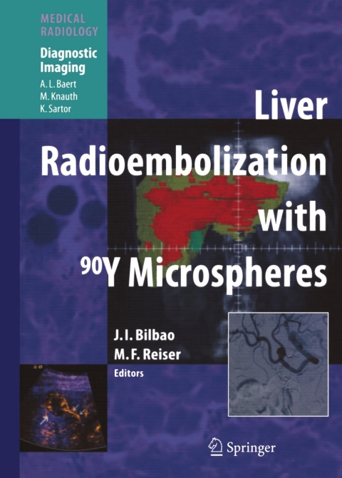 Cover image for book Liver Radioembolization with 90Y Microspheres