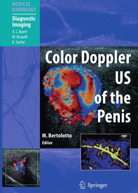 Cover image for book Color Doppler US of the Penis