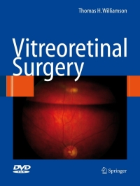 Cover image: Vitreoretinal Surgery 9783540375814