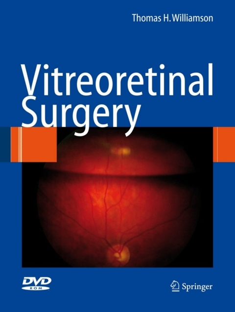 Vitreoretinal Surgery 