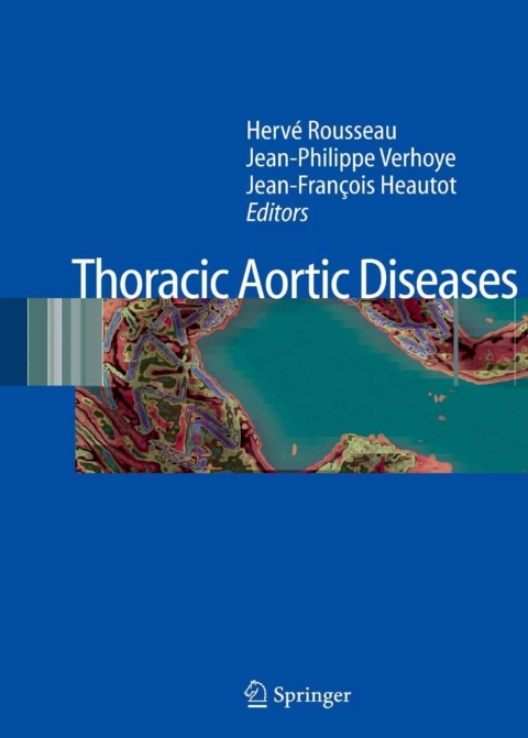 Cover image for book Thoracic Aortic Diseases