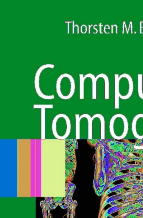 Computed Tomography 
