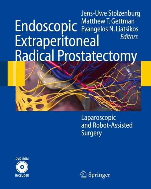 Cover image for book Endoscopic Extraperitoneal Radical Prostatectomy