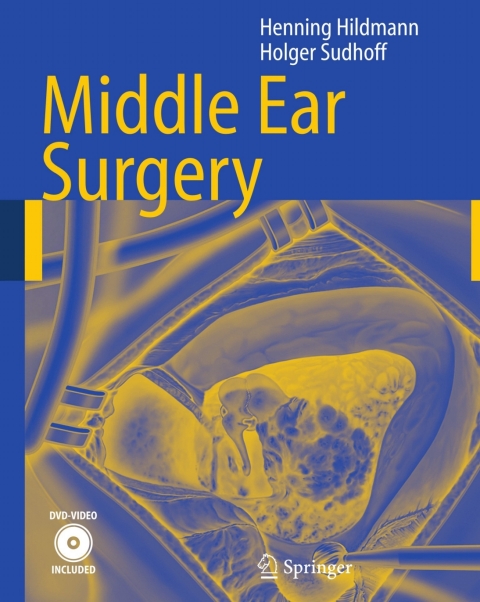 Cover image for book Middle Ear Surgery