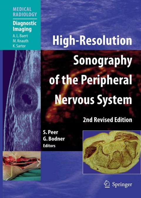 Cover image for book High-Resolution Sonography of the Peripheral Nervous System