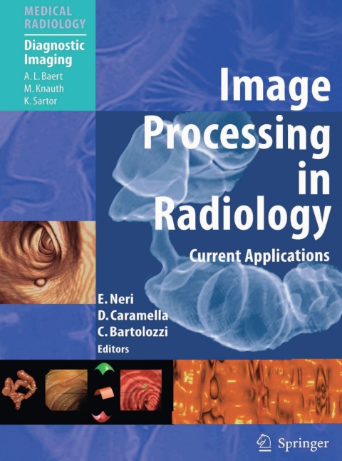 Cover image for book Image Processing in Radiology