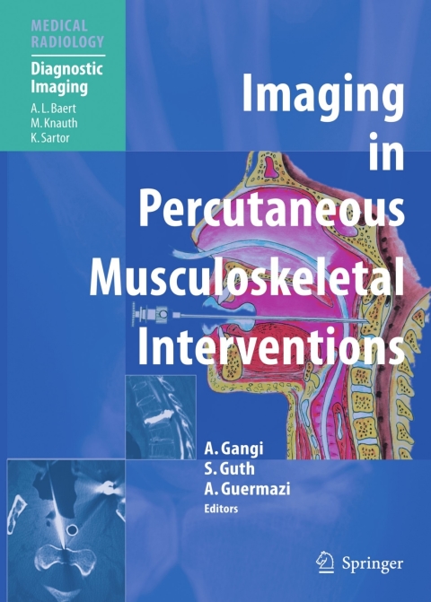 Cover image for book Imaging in Percutaneous Musculoskeletal Interventions