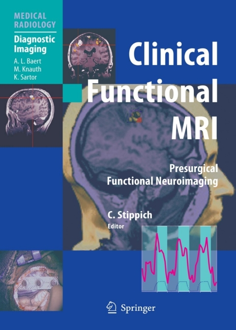 Cover image for book Clinical Functional MRI