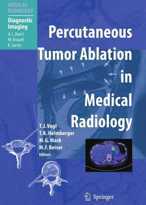 Cover image for book Percutaneous Tumor Ablation in Medical Radiology