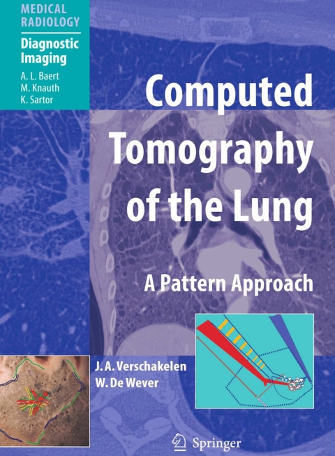 Cover image for book Computed Tomography of the Lung