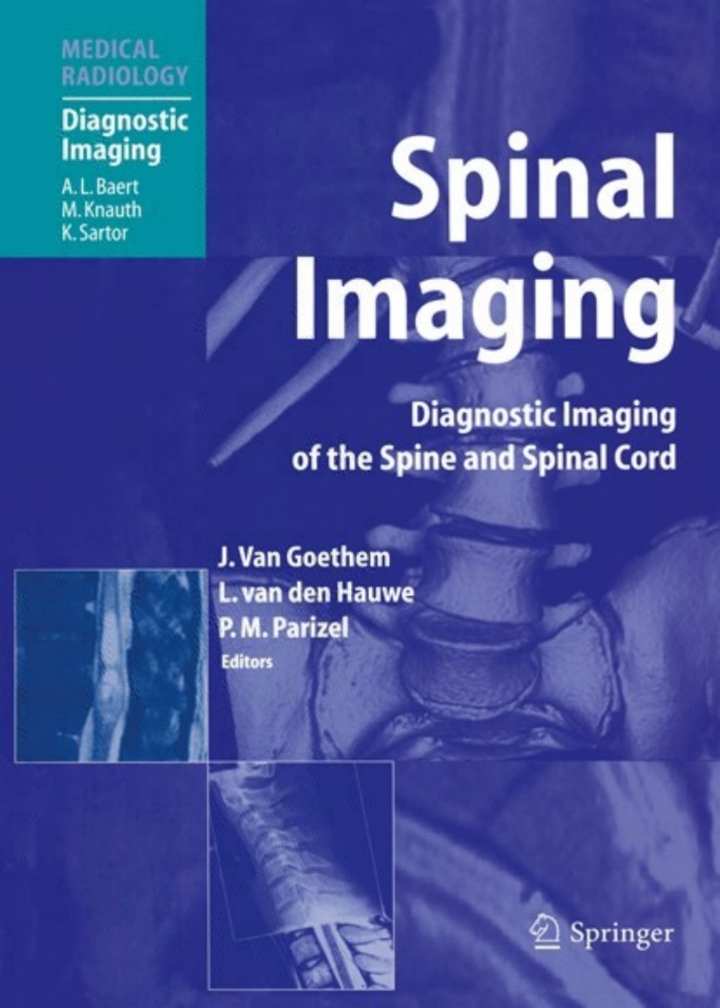 Spinal Imaging - 1st Edition (eBook Rental)