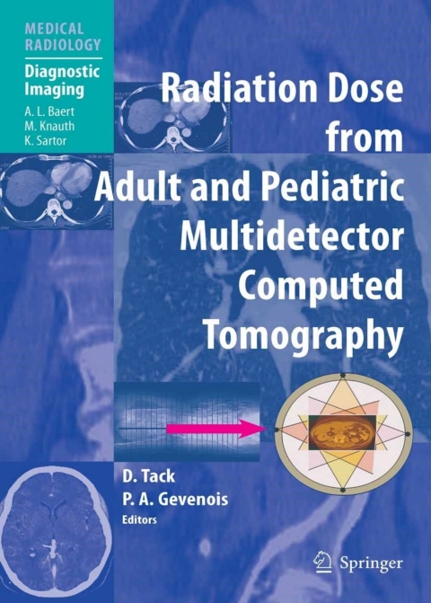 Cover image for book Radiation Dose from Adult and Pediatric Multidetector Computed Tomography