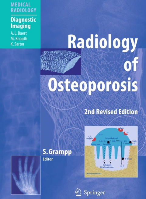 Cover image for book Radiology of Osteoporosis