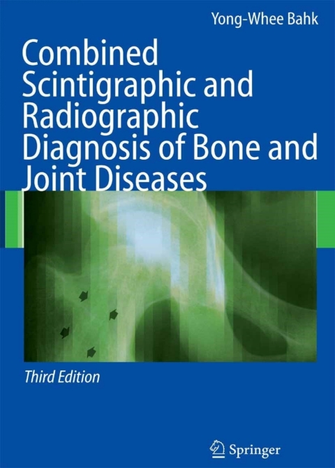 Cover image for book Combined Scintigraphic and Radiographic Diagnosis of Bone and Joint Diseases