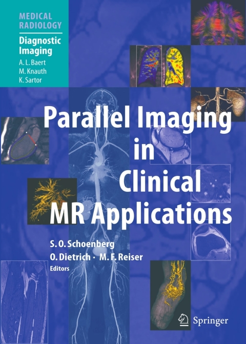 Cover image for book Parallel Imaging in Clinical MR Applications