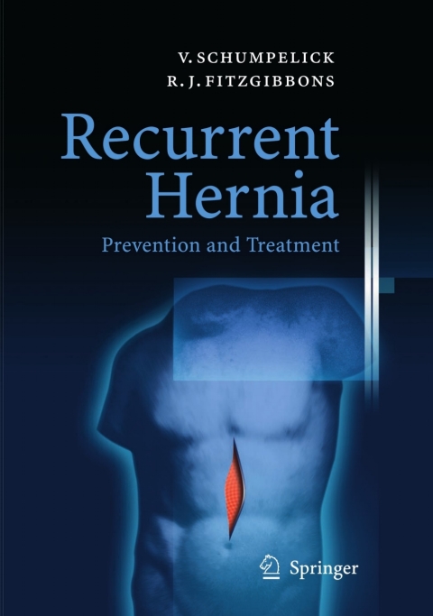 Cover image for book Recurrent Hernia