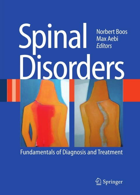 Cover image for book Spinal Disorders