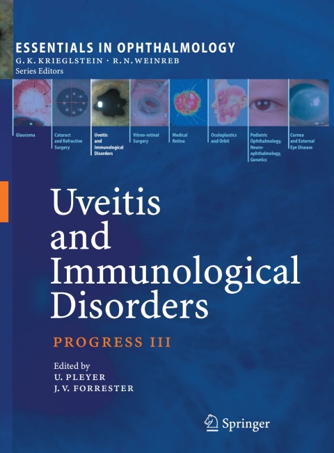 Cover image for book Uveitis and Immunological Disorders