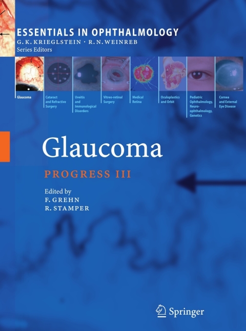 Cover image for book Glaucoma