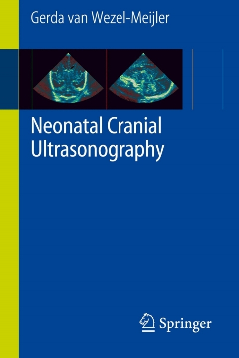 Cover image for book Neonatal Cranial Ultrasonography
