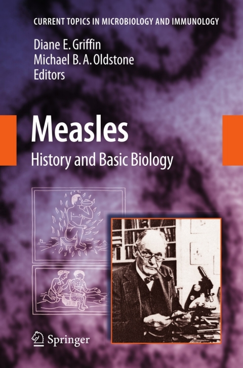 Cover image for book Measles