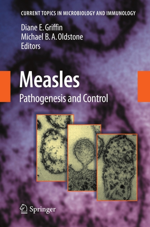 Cover image for book Measles